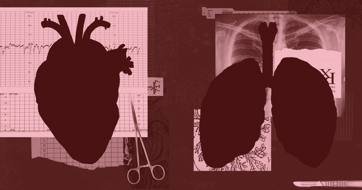 How Cleveland Became the Last-Chance Capital for Heart and Lung Transplant Patients