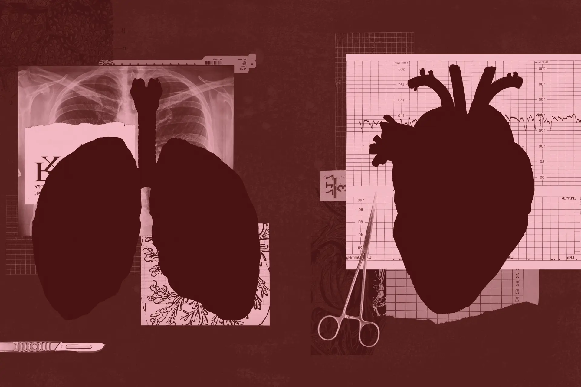 Transplant Programs at Cleveland Clinic, University Hospitals Give Many Second Chances: CLE Daily