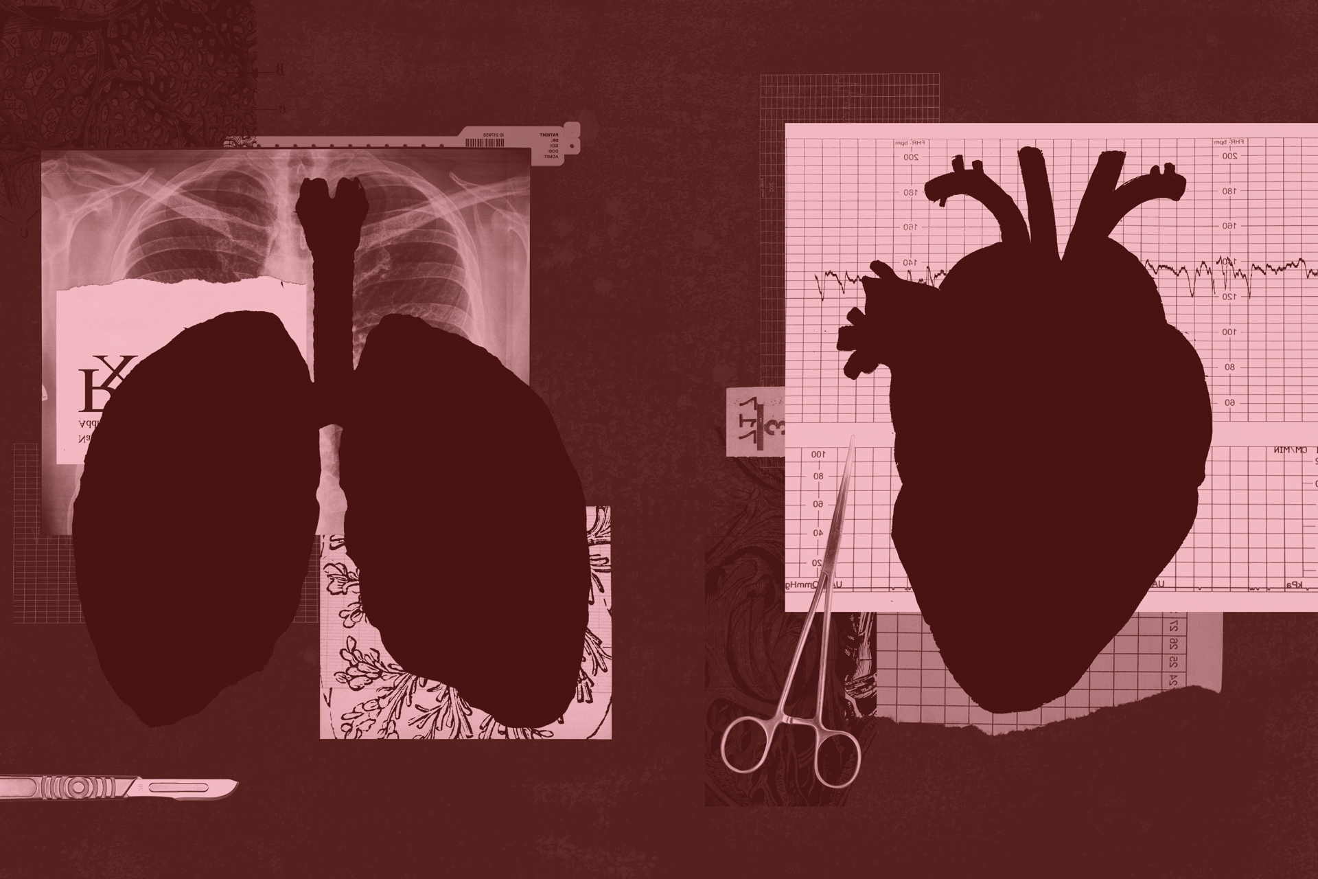 Transplant Programs at Cleveland Clinic, University Hospitals Give Many Second Chances: CLE Daily